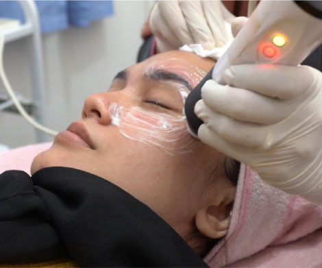 Puffy Eyes Treatment